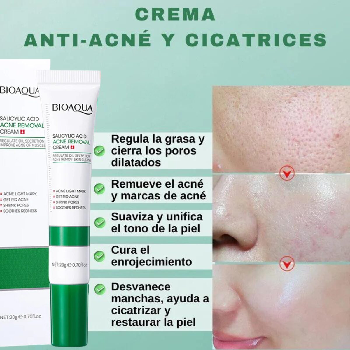Crema Antiacné de Acido Salicílico Bioaqua